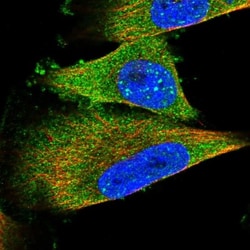 TEL2 Antibody, Novus Biologicals 25 &mu;L; Unlabeled:Antibodies, Polyclonal